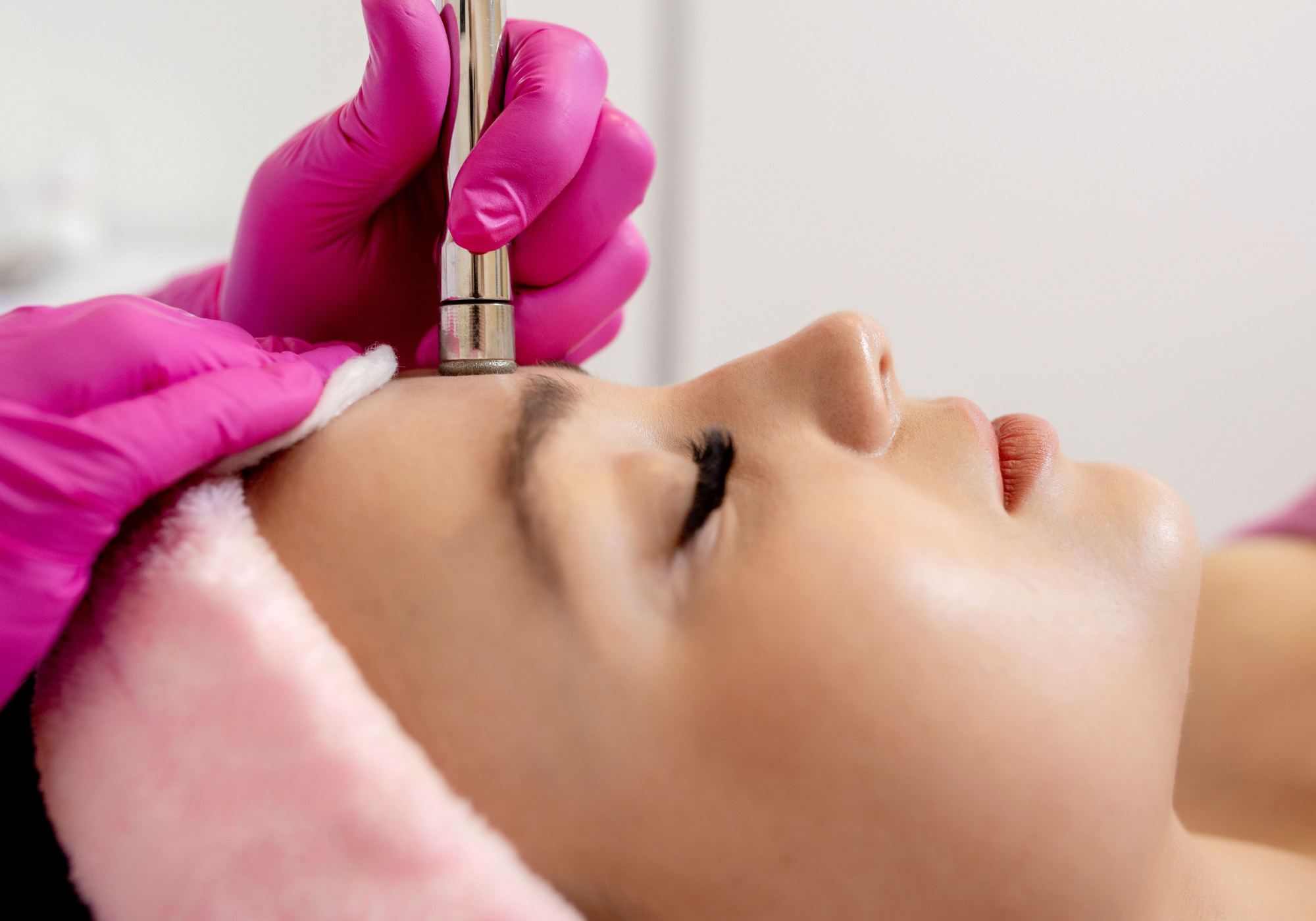 Microdermabrasion